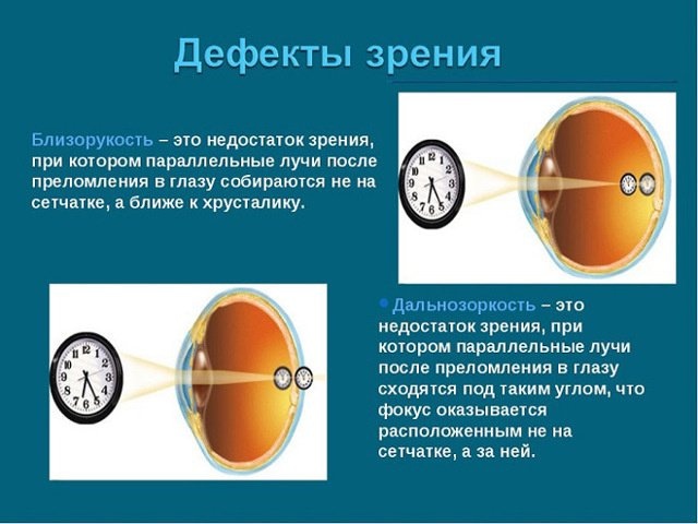 ТОП-9 глазных капель для лечения дальнозоркости: обзор с ценами
